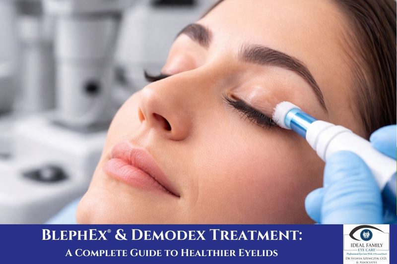 BlephEx® & Demodex Treatment A Complete Guide to Healthier Eyelids